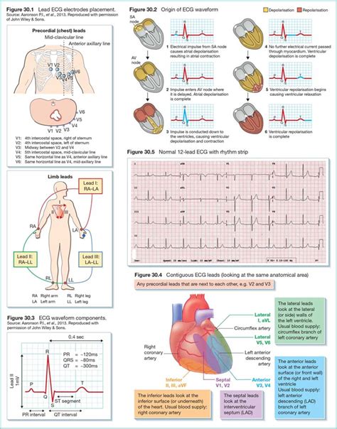 12 Lead ECG Reference Chart | ubicaciondepersonas.cdmx.gob.mx