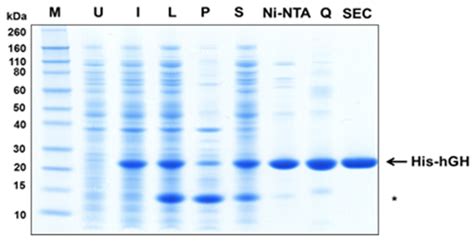 perdea emoţional financiar sds page electrophoresis marker map Buclă ...