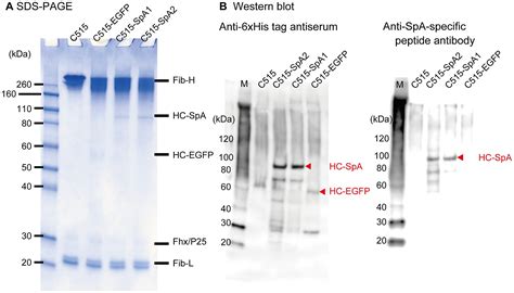 Free photo: Gel electrophoresis - Acids, Genetic, Sequencing - Free ...