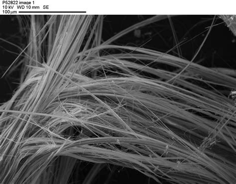 Asbestos Fibers Under Microscope