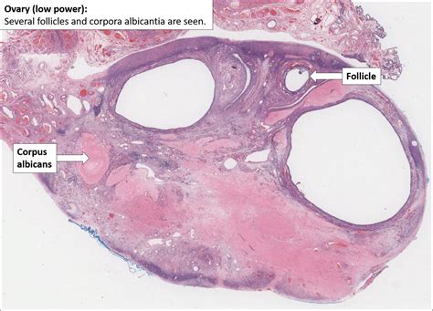 Ovary – Normal Histology – NUS Pathweb :: NUS Pathweb