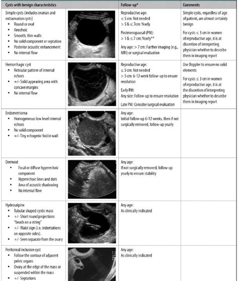 Ovarian Cyst F/U Guideline – Radiology.World