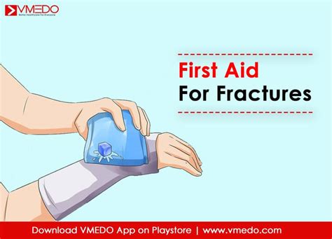 First Aid Treatment For Fractures - VMEDO Blog