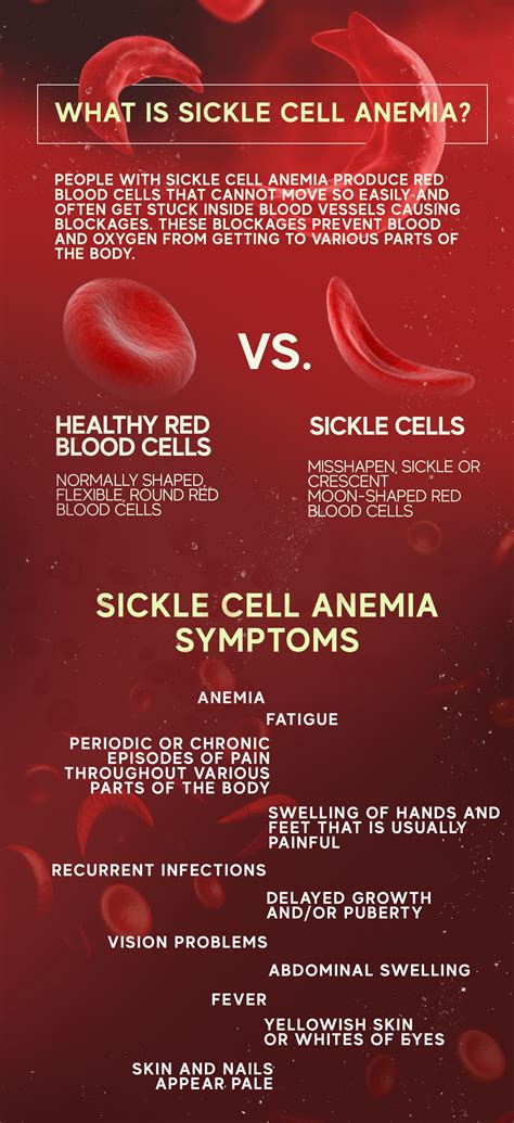 Sickle Cell Anemia: Cause, Symptoms and Treatment – The Amino Company