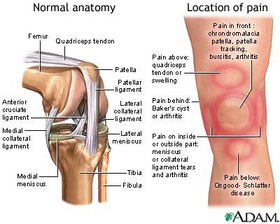 Knee pain: MedlinePlus Medical Encyclopedia Image