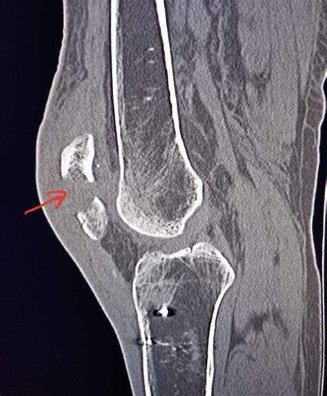 Pin von majeja84 auf radiologija | Röntgen, Abc