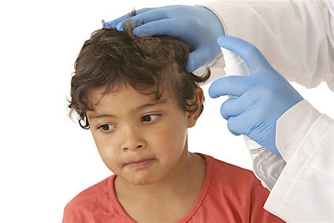 Lice Treatment For Children – Things Parenting