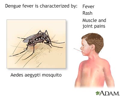 Dengue Fever Symptoms, Doctors, Treatments, Advances & More | MediFind