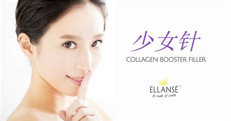 Ellanse Collagen Filler | Revealing Natural Results