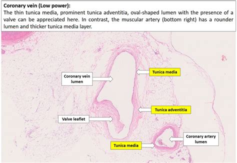 Blood vessels – Normal Histology – NUS Pathweb :: NUS Pathweb