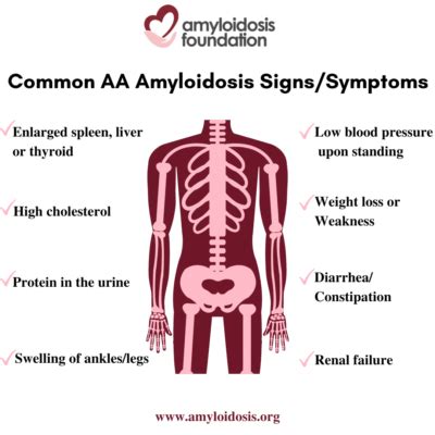 AA Amyloidosis | Amyloidosis Foundation