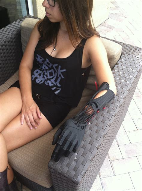 This Has to Be the Best-Looking 3D Printed Prosthetic Arm Ever