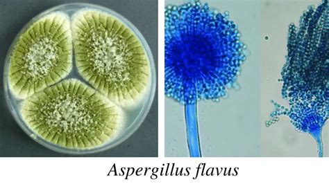 Aspergillus: Morphology, Clinical Features, and Lab Diagnosis • Microbe ...