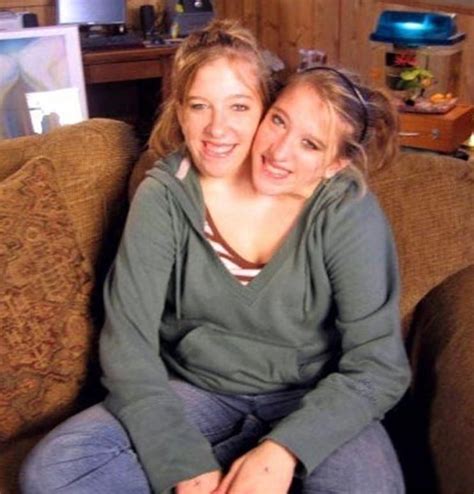 30 Fun Things About Conjoined Twins Abby and Brittany Hensel - The Frisky