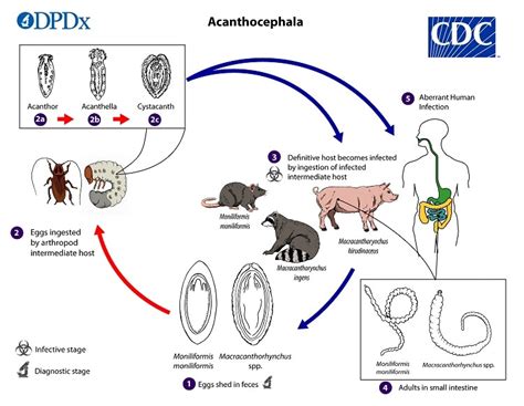 CDC - DPDx - Acanthocephaliasis