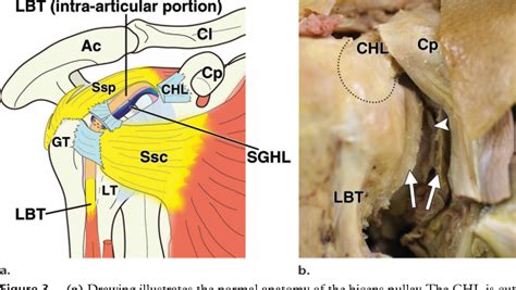 Biceps Pulley Anatomy