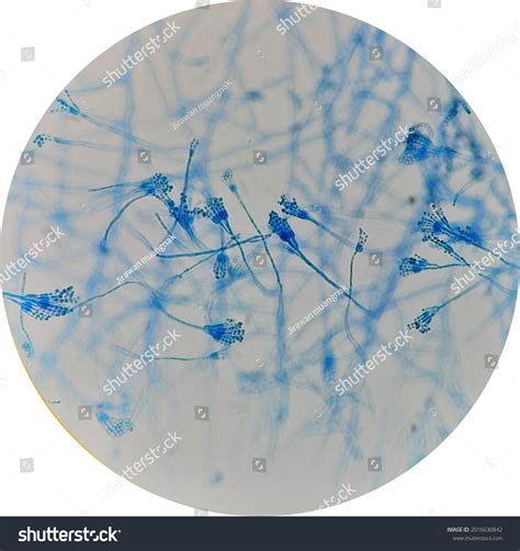 10 imágenes de Penicillium sp - Imágenes, fotos y vectores de stock ...