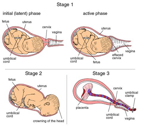 Stages of Labor Chart | dare alla luce doula