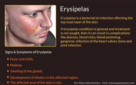 erysipelas caused by strep pyogenes | Skin, Skin diseases, Skin conditions