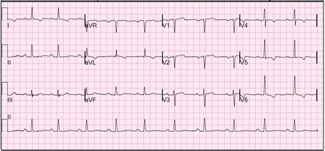 ECG Course