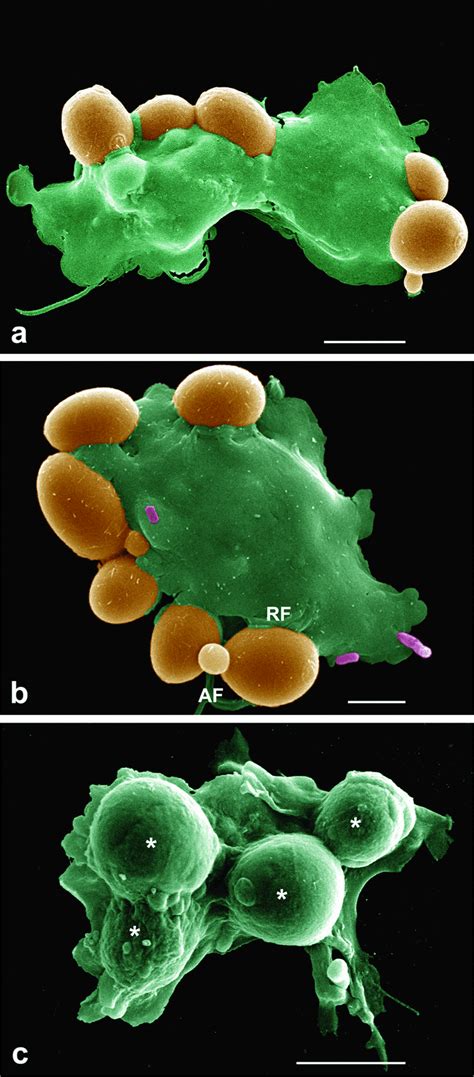 Phagocytosis Microscope