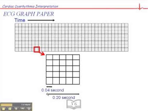 Ecg Graph Paper