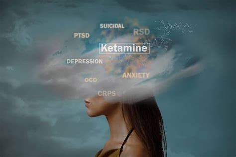 Who is not a good candidate for ketamine therapy? - Mid Hudson ...