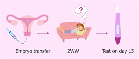 What to expect after embryo transfer