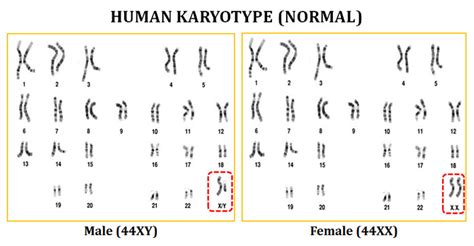 Karyotype Analysis of Human Chromosome | easybiologyclass | Chromosome ...