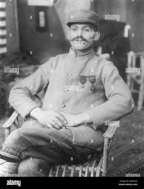 Facially-Disfigured WWI Soldier Wearing Mask Stock Photo - Alamy