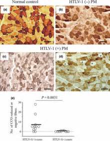 Enzyme histochemistry for cytochrome c oxidase (CCO). (a) Normal CCO ...