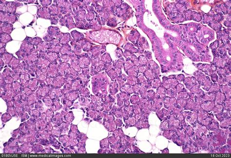 Histology Of Parotid Gland