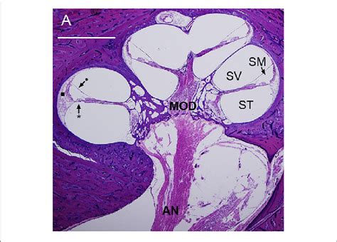 | Mid-modiolar section of a human cochlea showing the modiolus (MOD ...