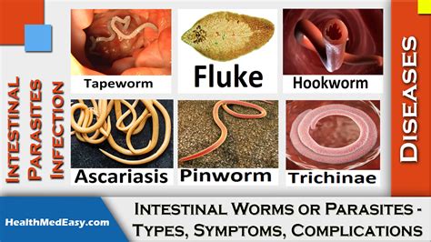 Worms (Intestinal) - Symptoms, Types, Complications - HealthMedEasy.com ...