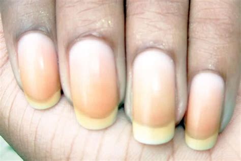 What Causes Nail Discoloration & How to Treat It | We Heart Nails