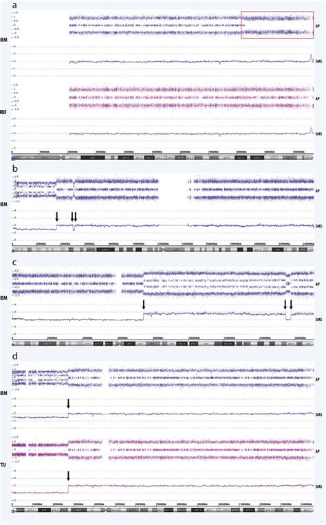 e SNP array profiles of BM-derived DTCs. a. SNP array data from an ...