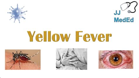 Yellow Fever | Pathogenesis (mosquitoes, virus), Signs & Symptoms ...