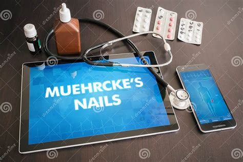 Muehrcke S Nails (cutaneous Disease) Diagnosis Medical Concept O Stock ...