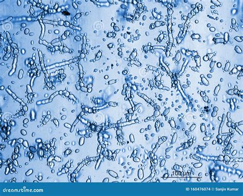 Fungus Like Growth Under the Microscope Stock Photo - Image of sample ...