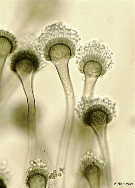 Aspergillus fumigatus microscopy