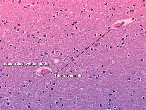 Brain Histology Labeled