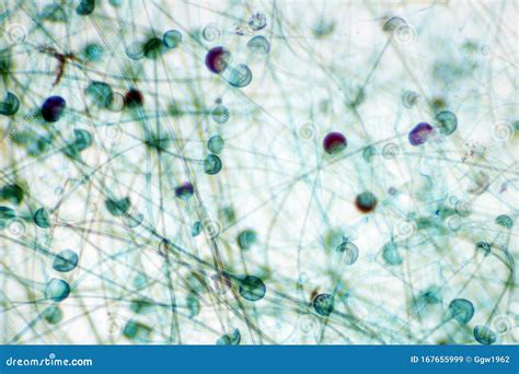 Mold sporangium stock image. Image of danger, environment - 167655999