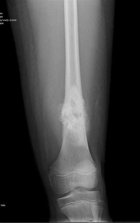 Pin on Muscuoloskeletal imaging