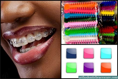 Best Braces Colors For Dark Skin - How To Choose - Orthodontic Braces Care