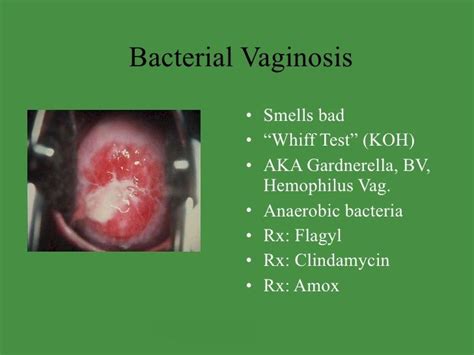 114 best Bacterial Vaginosis images on Pinterest | Bacterial infection ...