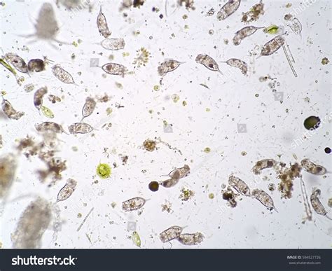 Freshwater Aquatic Plankton Under Microscope View Stock Photo 594527726 ...