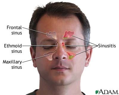 Sinus Pressure Points | Med-Health.net