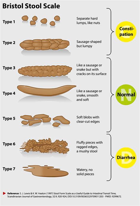 Bristol Stool Chart