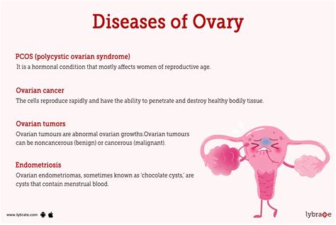 Ovary (Human Anatomy): Picture, Function, Diseases, Tests, and Treatments