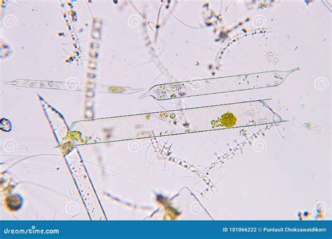 Marine Aquatic Plankton Under Microscope View Stock Photo - Image of ...